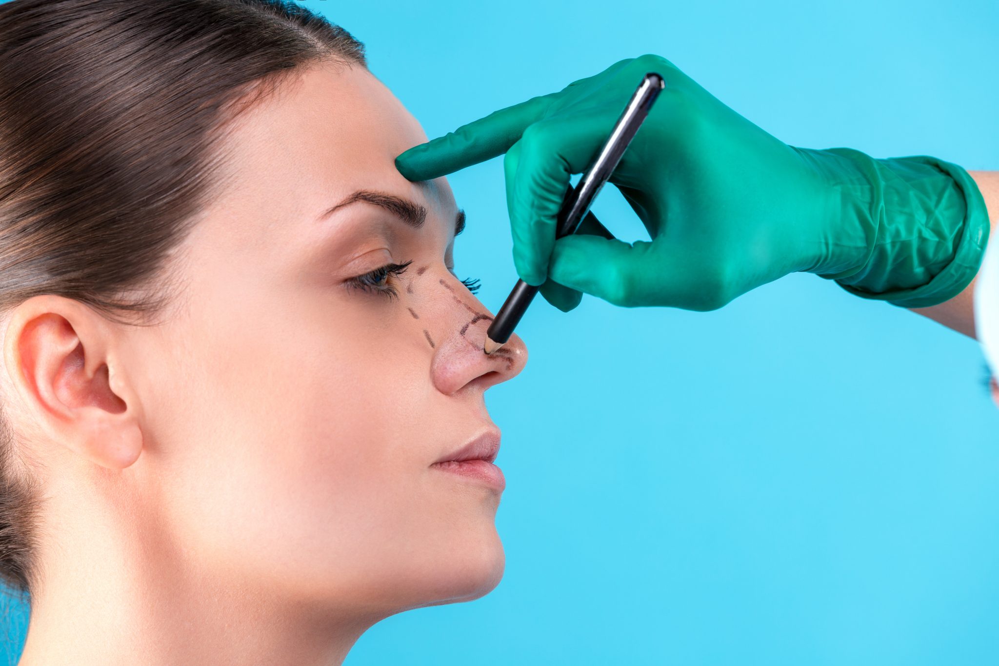 Would I Benefit From Rhinoplasty?